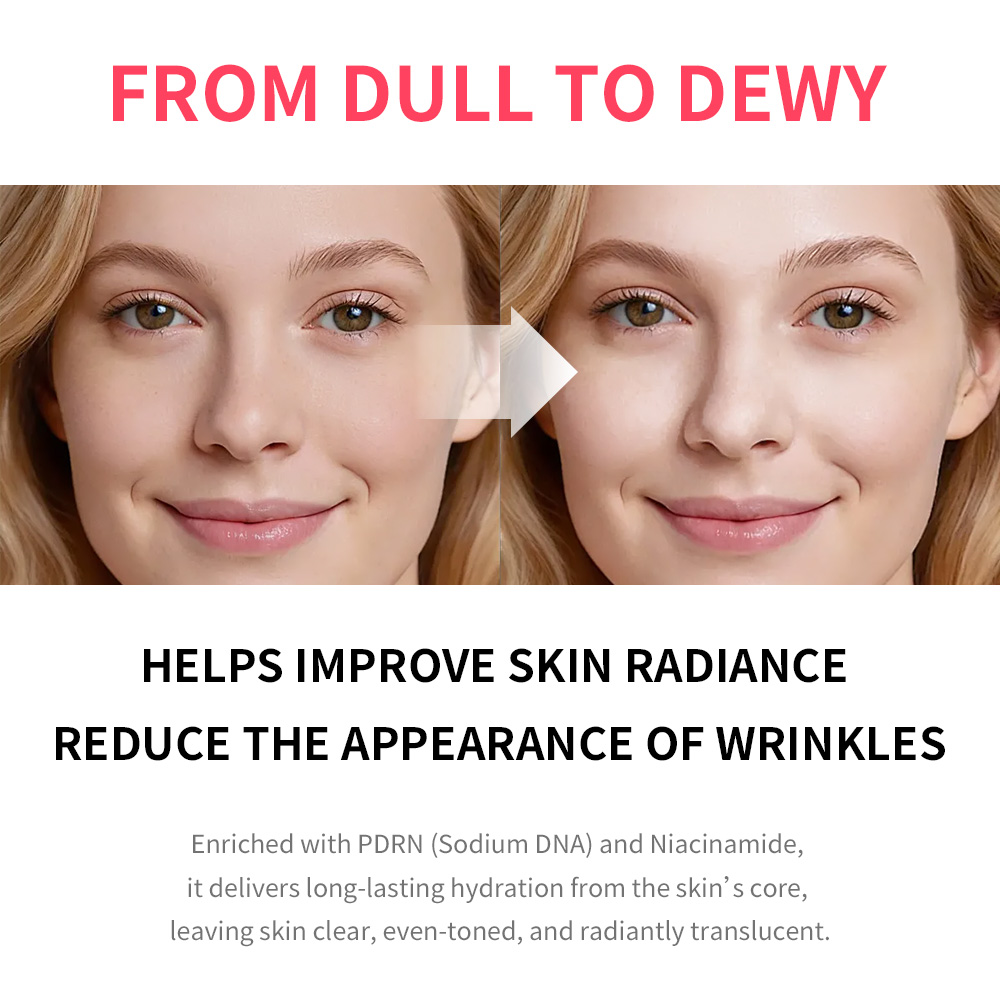 PDRN Pink Niacinamide Milky To - Echinacea recension och pris